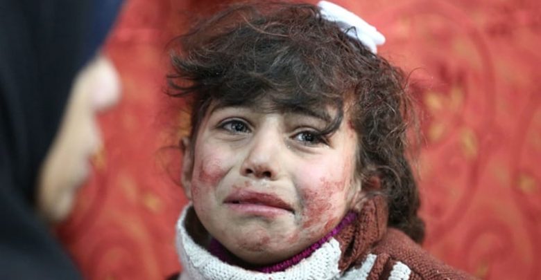 A young girl receives treatment at a makeshift hospital following regime bombardments in Eastern Ghouta region [Amer Almohibany/AFP]