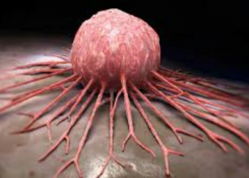 کینسر،  سرطان ناروغي